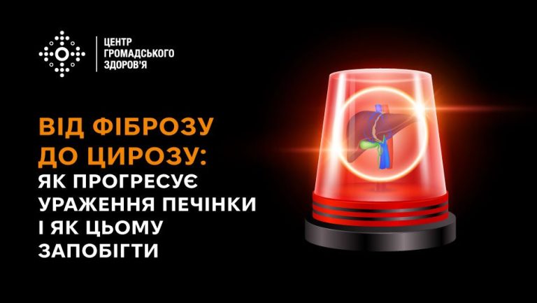 Від фіброзу до цирозу: як прогресує ураження печінки і як цьому запобігти